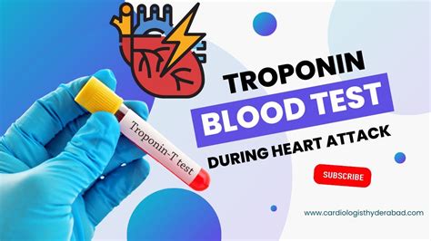 troponin blood test bottle|when to do repeat troponin.